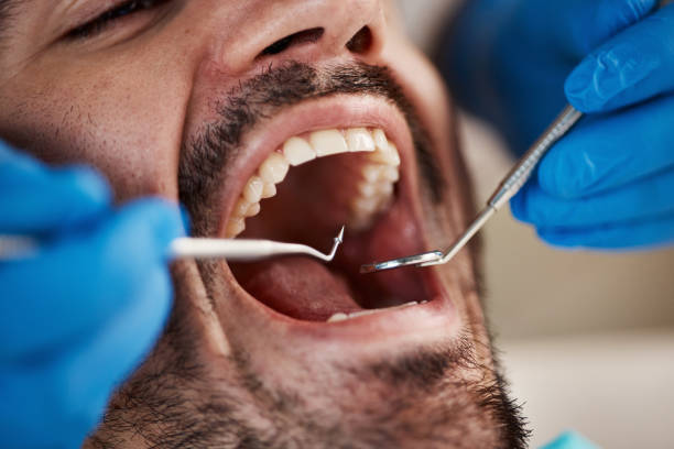 Best Cracked Tooth Emergency Dentist  in Hazleton, PA